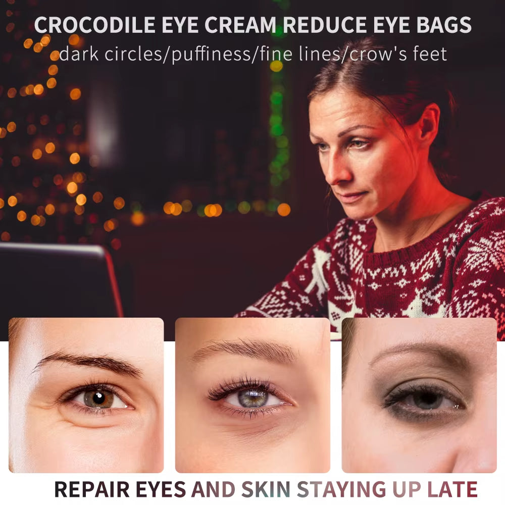 20G Peptide Collagen Eye Essence Cream anti Wrinkle anti Dark Circles Eye Bags Eyes Puffy Repair Korean Cosmetics Eye Care